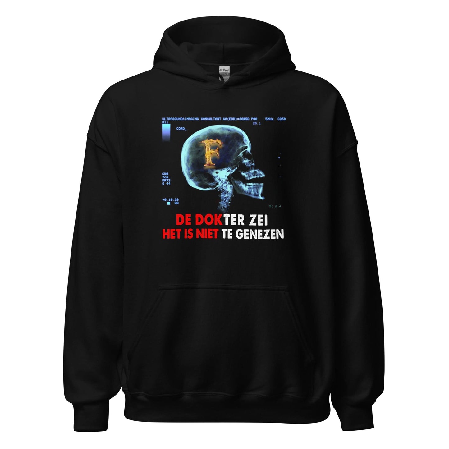 Unisex hoodie (Het is niet te genezen) 010